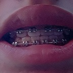 bracesfetish OnlyFans Leaked 

 profile picture