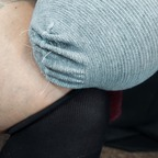 View notoesnoleftleg (QueenUniPed) OnlyFans 49 Photos and 32 Videos gallery 

 profile picture