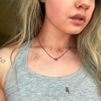 sydney_spiderz (Sydney Spiderz) OnlyFans content 

 profile picture